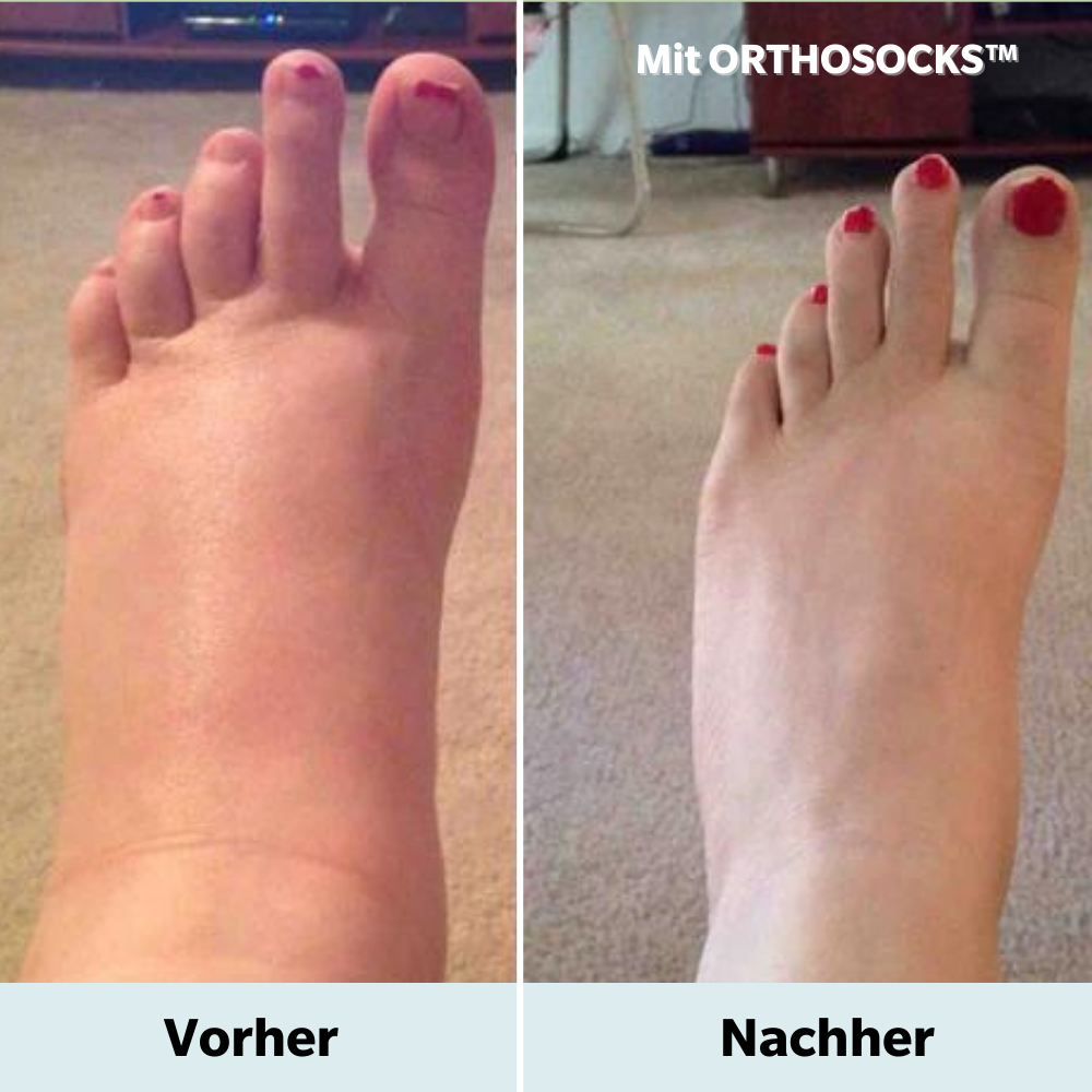 ORTHOSOCKS™  zehenfreie orthopädische Kompressionssocken